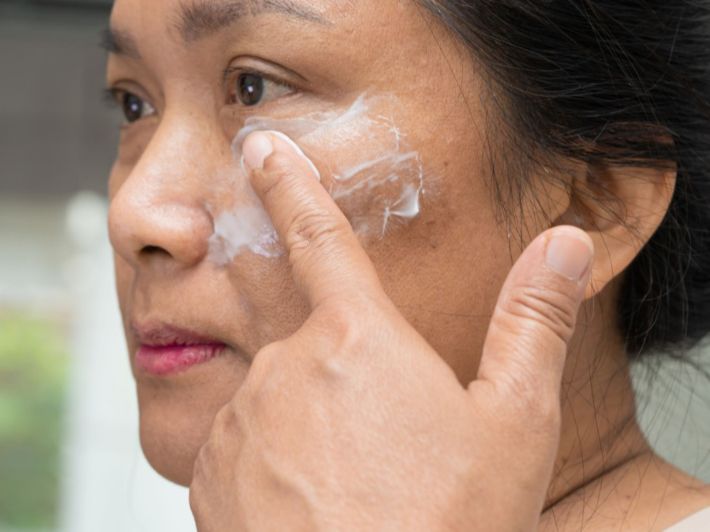 ما هو أفضل كريم لعلاج كلف الحمل؟