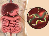 The Most Important Symptoms of Helicobacter Pylori