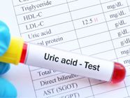 High Uric Acid: Causes, Treatment, and More!