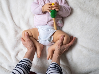 Congenital Hip Dislocation