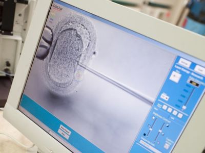What’s the Difference Between ICSI and IVF?