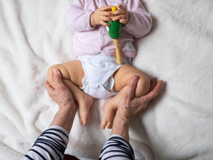 Congenital Hip Dislocation