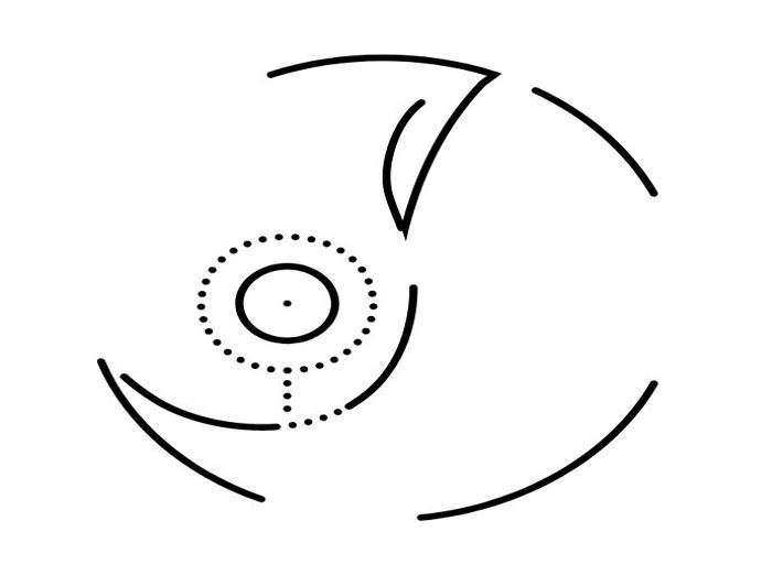 Breast Reduction Surgery: When and Why You Might Need It