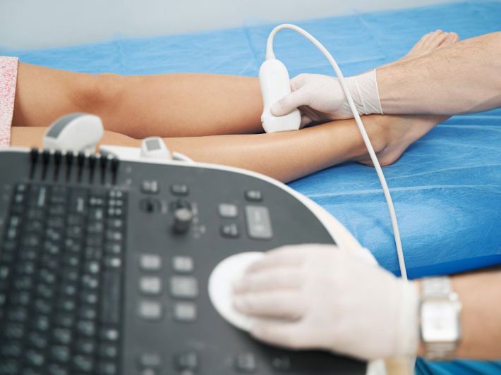 Doppler Ultrasound for the Legs: What It Is and How It’s Done