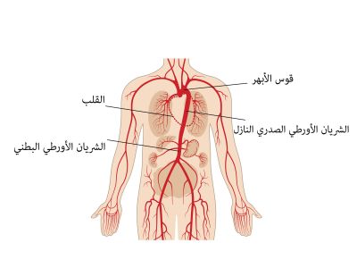 الأورطي: أكبر وأهم شريان في القلب الأورطي: أكبر وأهم شريان في القلب