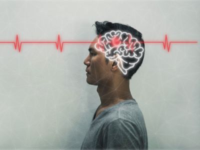 ما بعد السكتة الدماغية: مدة التعافي، إعادة التأهيل والأدوية ما بعد السكتة الدماغية: مدة التعافي، إعادة التأهيل والأدوية