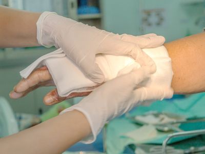 أهم المعلومات: حروق الدرجة الرابعة