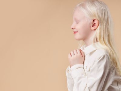 أهم المعلومات: مرض البرص