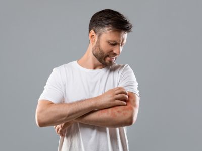 التهاب الجلد: الأعراض، الأسباب والعلاج