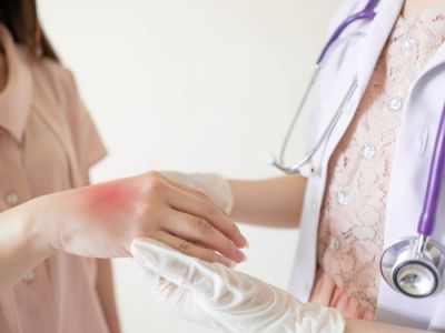 التهاب الجلد البكتيري: الأنواع, الأعراض والعلاج