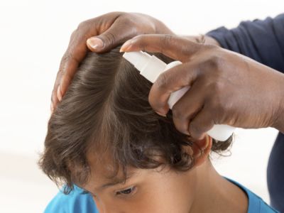 طريقة استخدام شامبو وبخاخ القمل