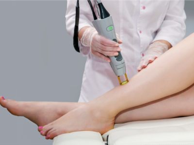 هل ليزر إزالة الشعر يضر الحامل؟ وهل هو مسموح في شهور الحمل الأولى؟