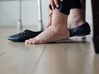 تورم القدمين: لماذا وماذا تفعل؟
