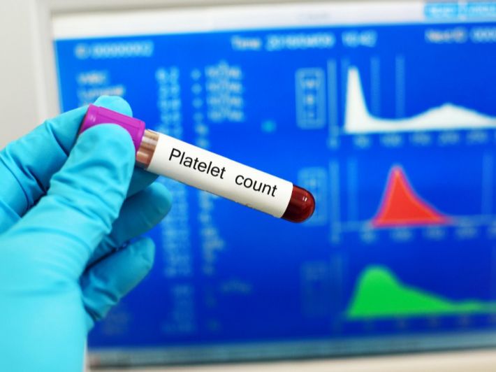 أسباب ارتفاع الصفائح الدموية عند الحامل