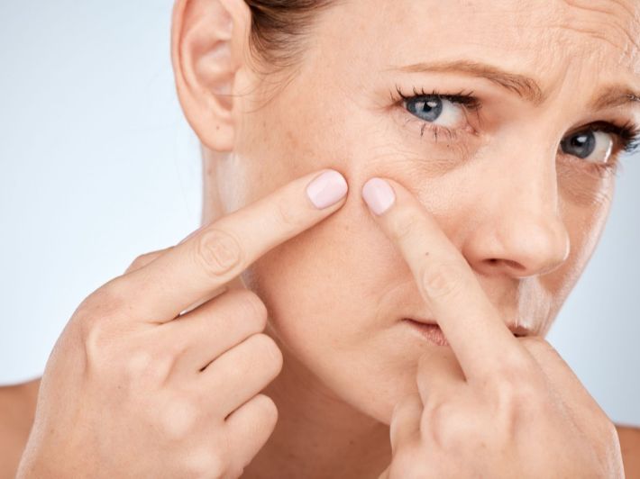 لبشرة خالية من الحبوب: إليك أهم النصائح لتجنب ظهورها