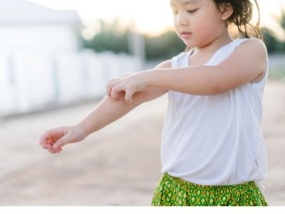 أهم المعلومات: حساسية الطعام عند الأطفال