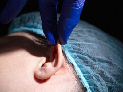 أنواع عمليات تجميل الأذن البارزة