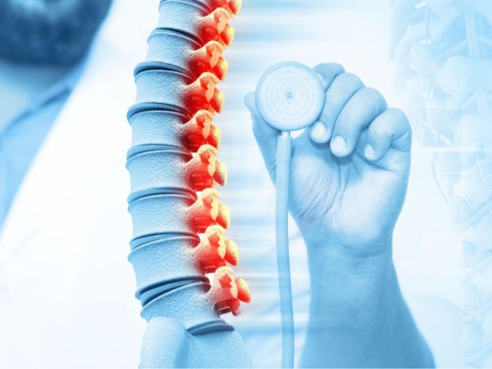 الفرق بين عرق النسا والشد العضلي