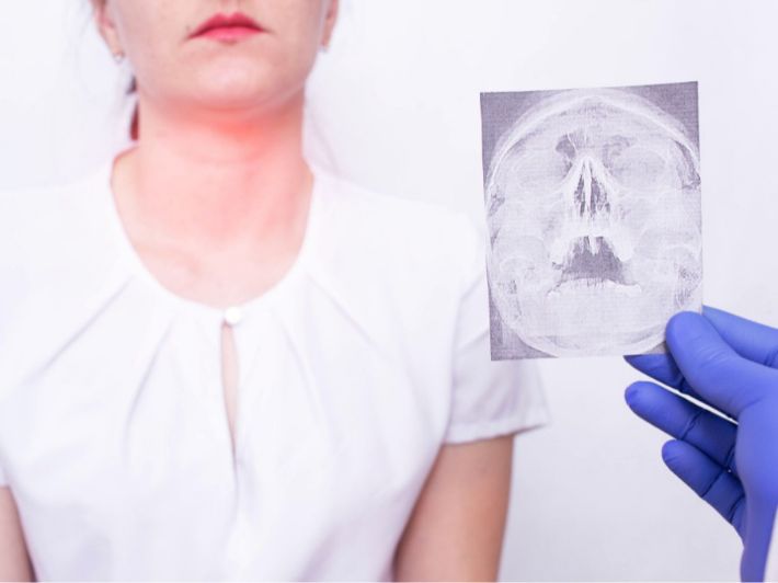 المرحلة الرابعة من سرطان الحنجرة