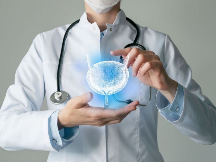 بحث عن الورم الحليمي في المثانة