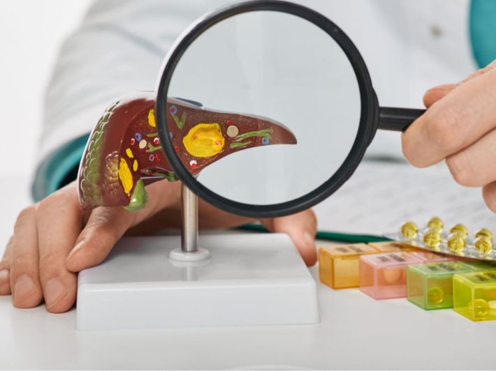 بحث عن تليف الكبد المرحلة الرابعة