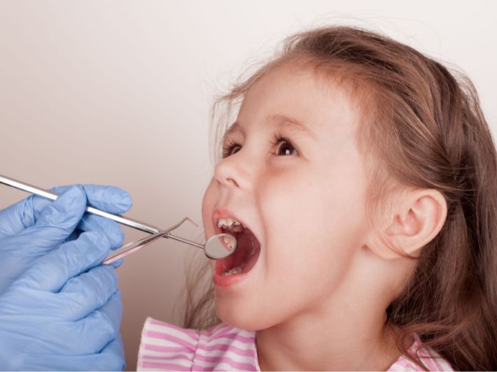 علاج التهاب اللثة عند الأطفال