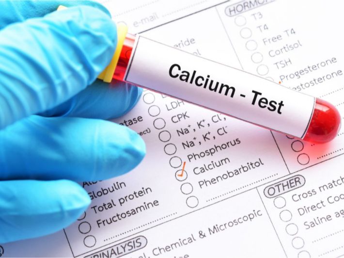 علاج زيادة الكالسيوم في الدم