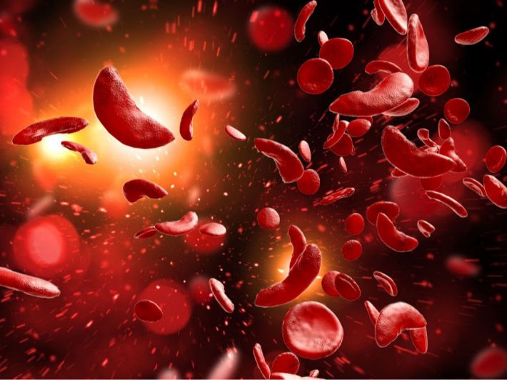 علاج فقر الدم المنجلي