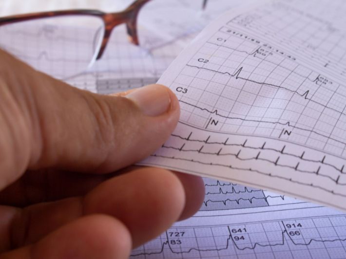 هل كهرباء القلب مرض وراثي؟