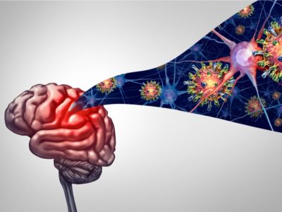 أعراض التهاب السحايا أعراض التهاب السحايا