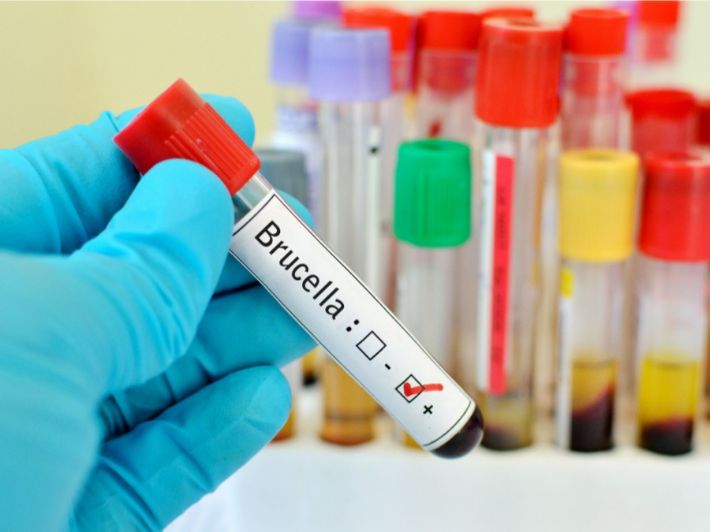 تحليل الحمى المالطية