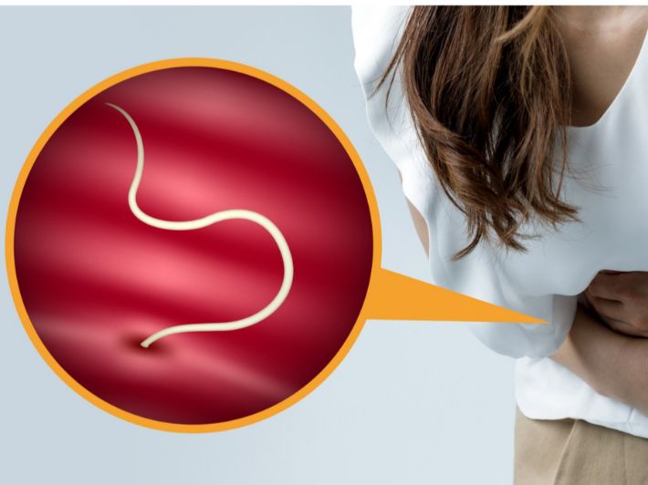 تشخيص الديدان في البطن