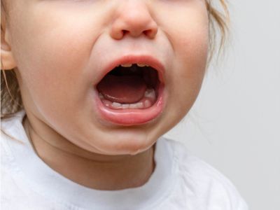 أعراض ظهور الطواحين عند الأطفال أعراض ظهور الطواحين عند الأطفال
