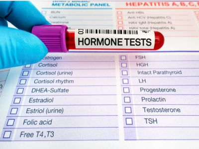 العلاقة بين ارتفاع هرمون الذكورة عند النساء وزيادة الوزن