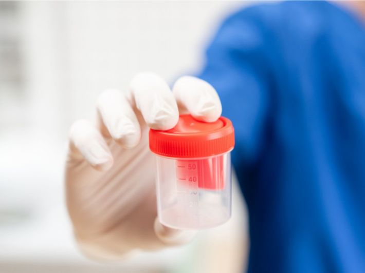 اختبار الأجسام المضادة للحيوانات المنوية (ASAB test)