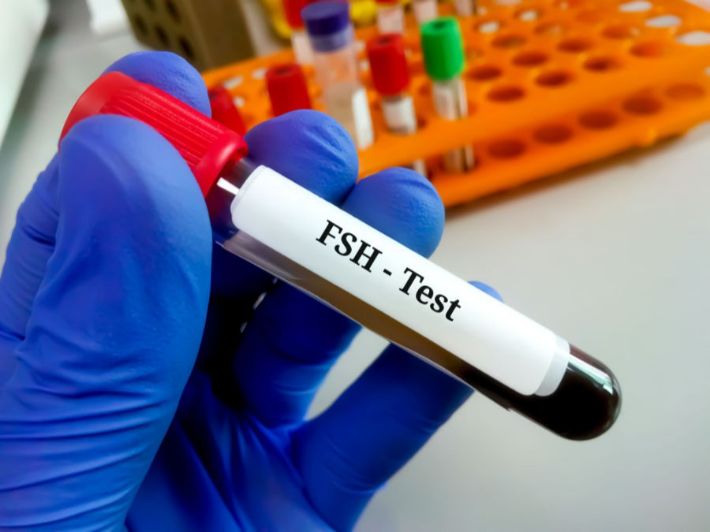 المستوى الطبيعي لتحليل الهرمون المنشط للجريب عند النساء (FSH)