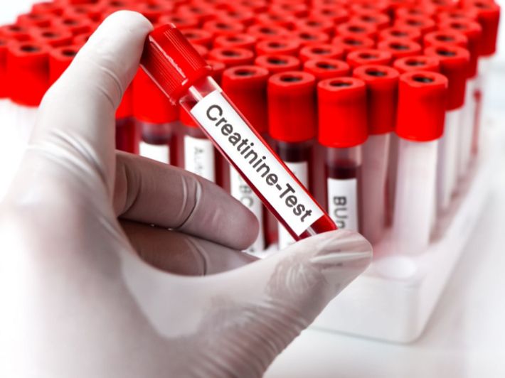 انخفاض نتيجة تحليل الكرياتنين (Creatinine): ماذا تعني؟