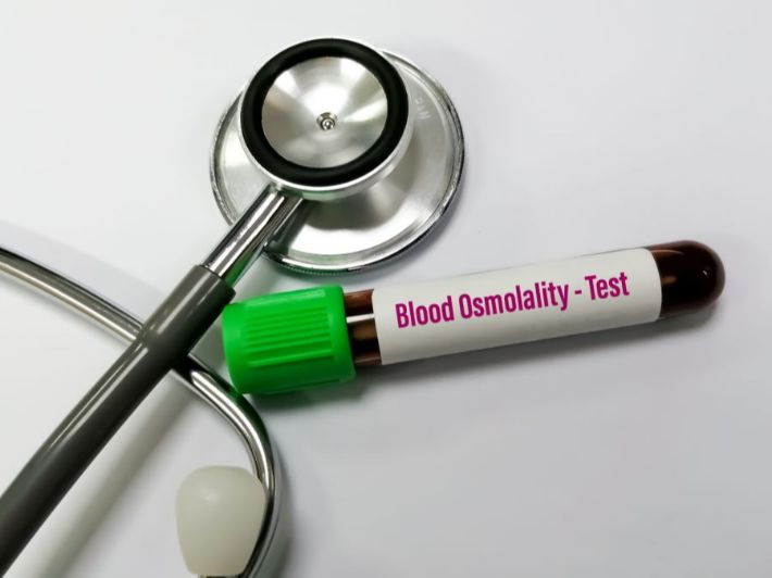 تحليل أسمولالية الدم