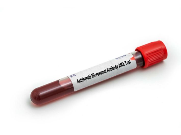 تحليل الأجسام المضادة للميتوكندريا (AMA)