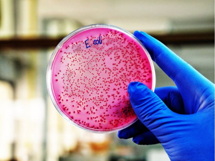تحليل البكتيريا الإشريكية القولونية (E.coli)