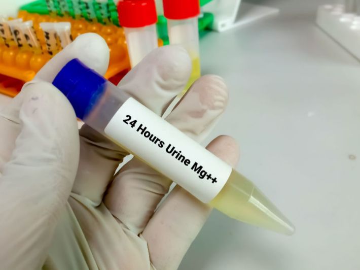 تحليل المغنيسيوم في البول (Mg urine test)
