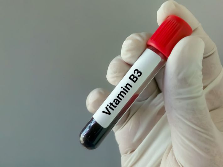 تحليل فيتامين (B3)