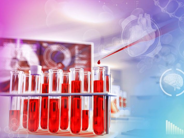 علاج ارتفاع الكلوريد في الدم