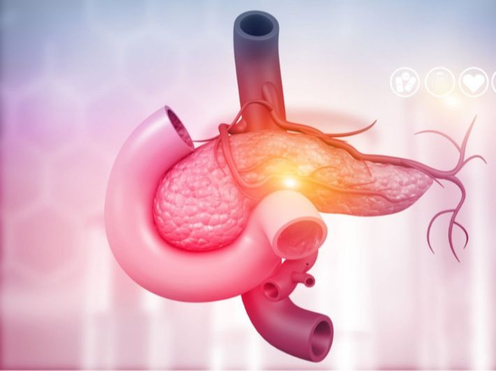 فحوصات وتشخيص سرطان البنكرياس