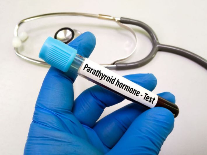ما أسباب ارتفاع تحليل PTH؟
