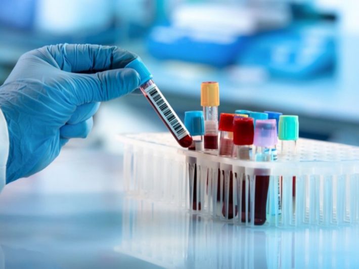 ما هي التحاليل التي توضح عن كفاءة عمل البنكرياس؟