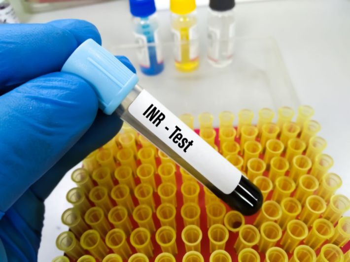 ما هي النسبة الطبيعية لتحليل INR؟