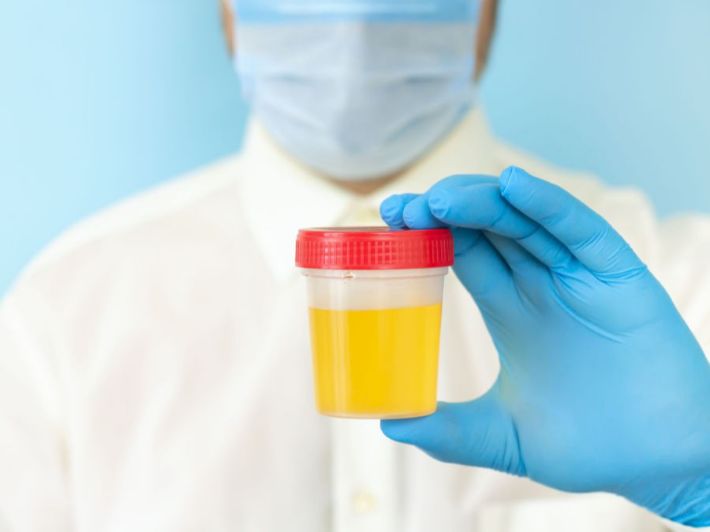 ما هي شروط تحليل البول بالتفصيل؟