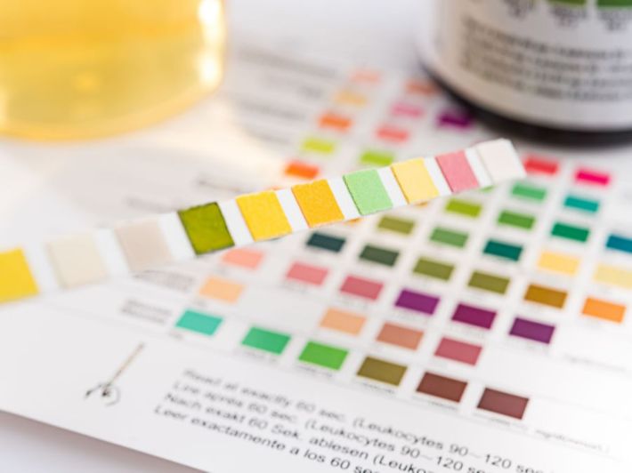 ما هي فحوصات الكشف عن درجة حموضة الدم؟