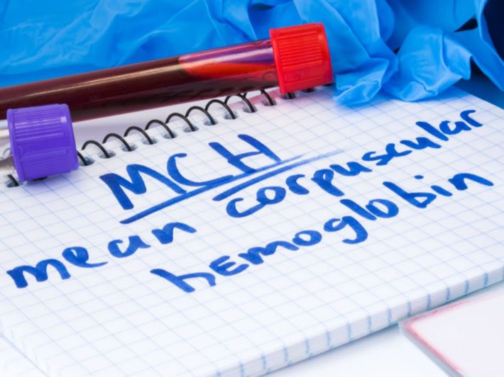 ماذا يعني انخفاض MCH في تحليل الدم؟
